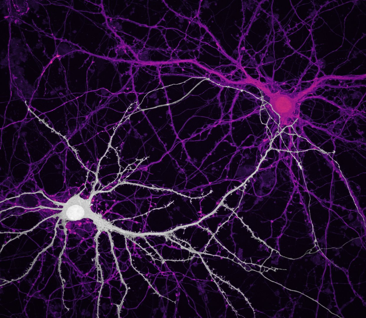 Sinapsis neuronal.