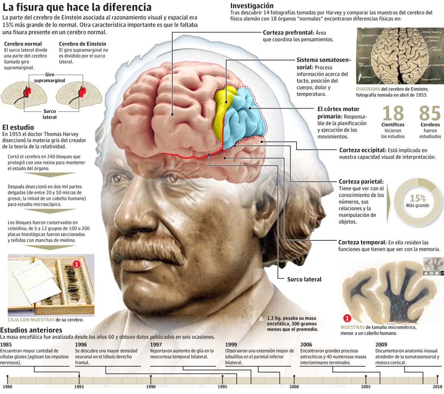 Detalles del cerebro de Einstein