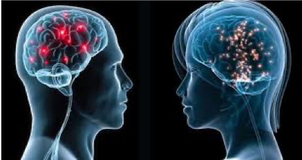 Diferencias cerebrales en los sexos