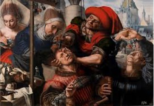 F28. Trepanación.