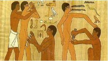 F34. Circuncisión en Egipto.